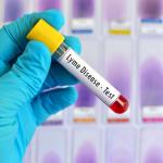 How To Test for Lyme Disease? Facts You Must Know