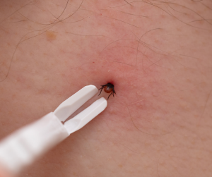 Test for Lyme Disease - You Drug Mart Test for Lyme Disease