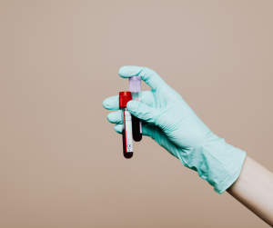 Alzheimer’s finger-prick test - You Drug Mart Alzheimer’s finger-prick test