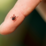 Tick Prevention for Humans: Best OTC Products, And Tested Solutions