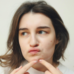 Acne Medication Names And Helpful Details You Need to Know