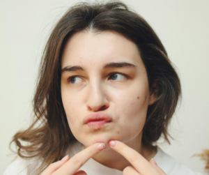 acne medication